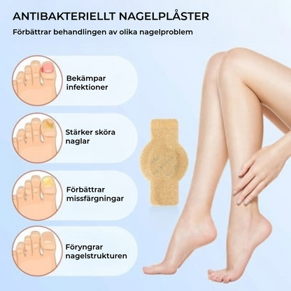 FungalPatch - Antibakteriell Svampdödande Plåster och Nagelvårdspaket