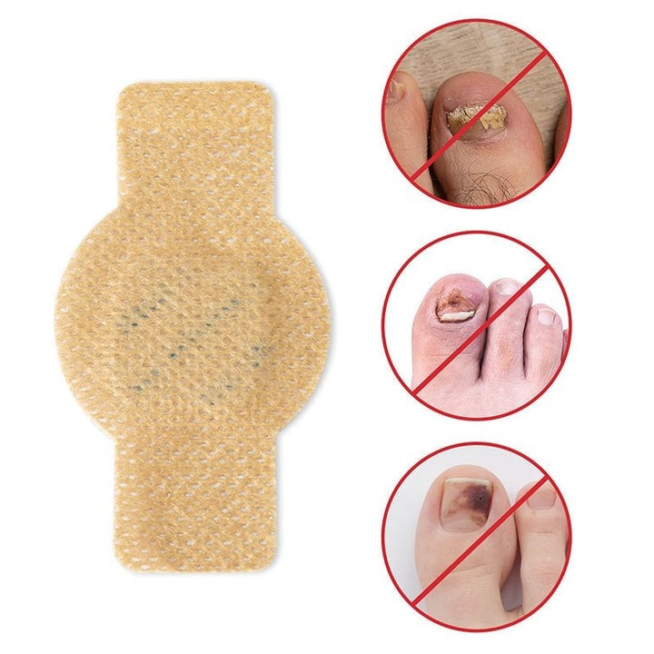 FungalPatch - Antibakteriell Svampdödande Plåster och Nagelvårdspaket