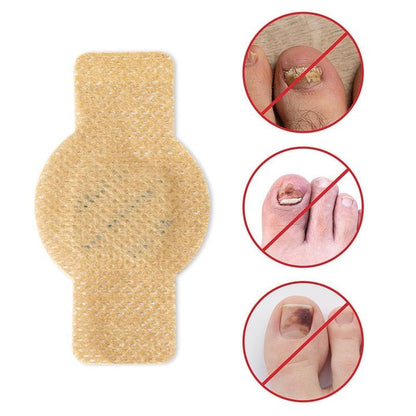 FungalPatch - Antibakteriell Svampdödande Plåster och Nagelvårdspaket
