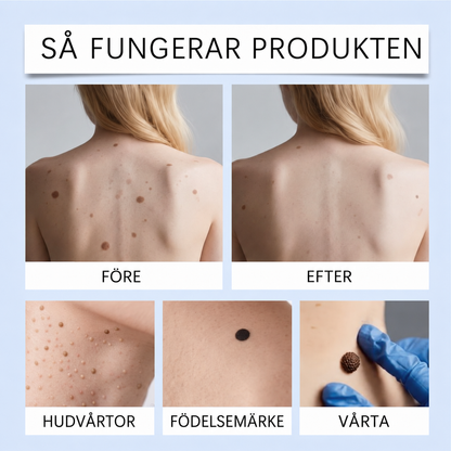 ClearRoller™ Roller Serum – avancerat för klar hud